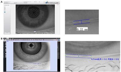 frontiers dry eye test